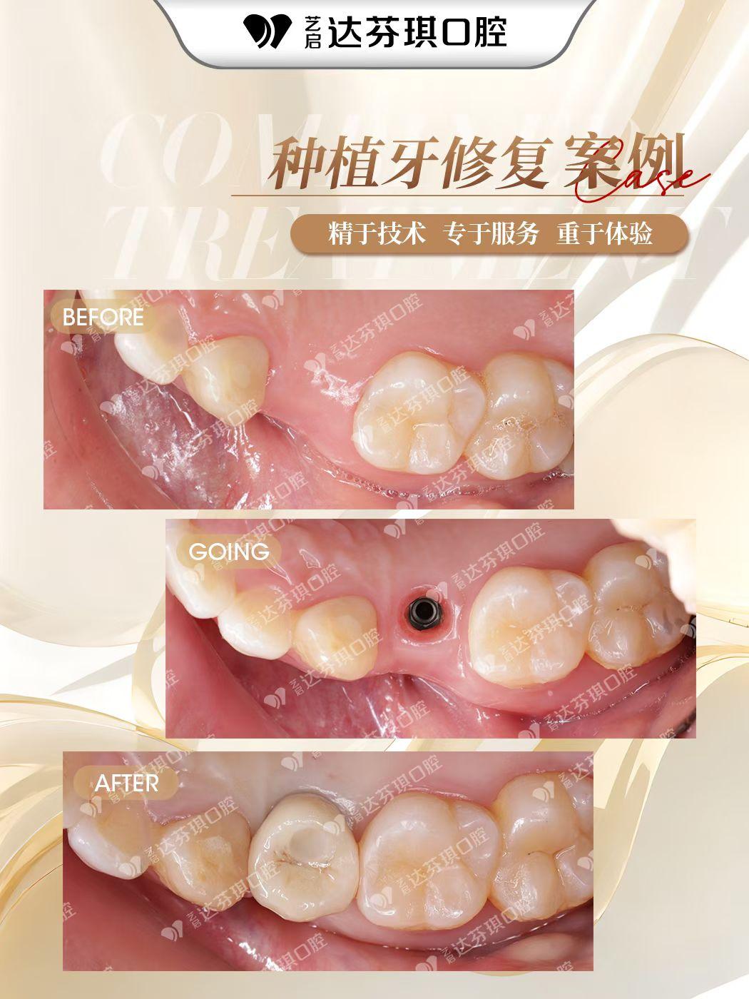 数字化正畸中心