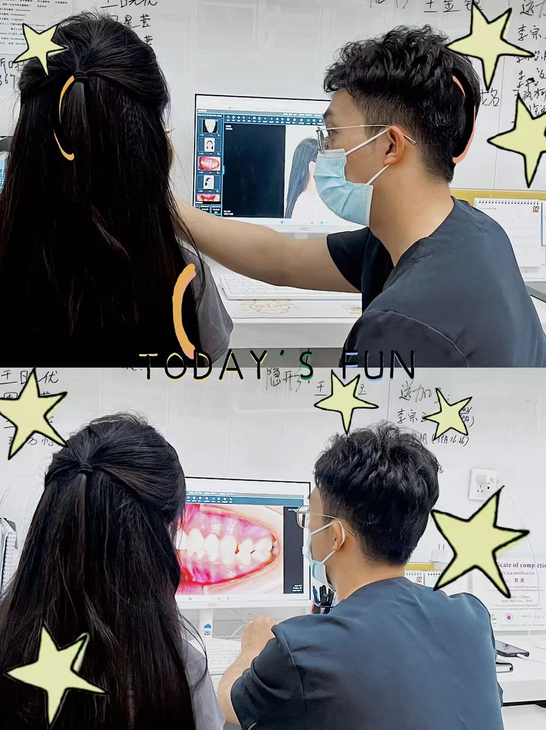 3M树脂补牙效果