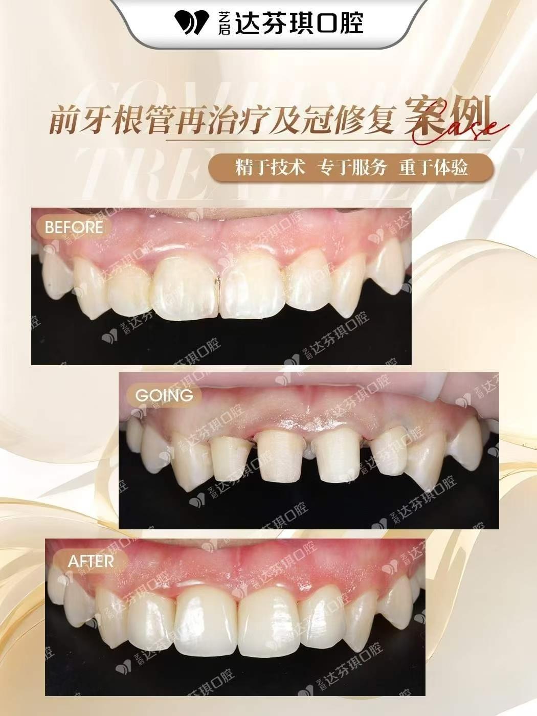 达芬琪口腔**团队