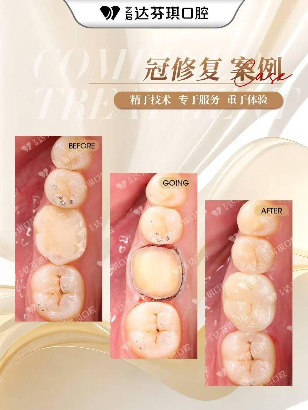 达芬琪口腔数字化诊疗