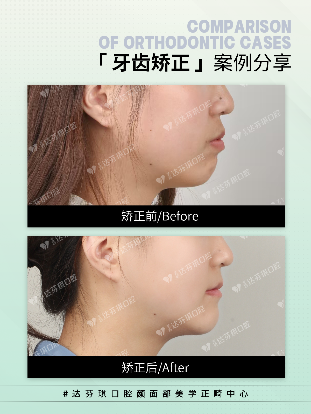 达芬琪口腔**环境